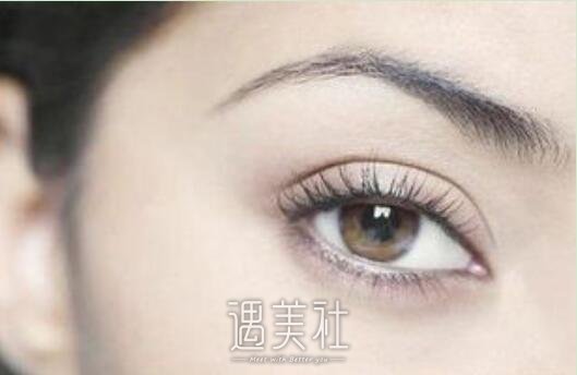 常州,激光去鱼尾纹