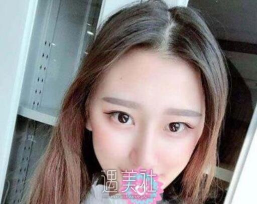 巫文云,鼻子