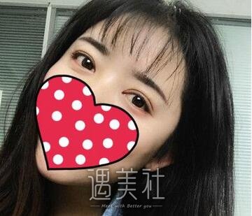 陈辉,双眼皮