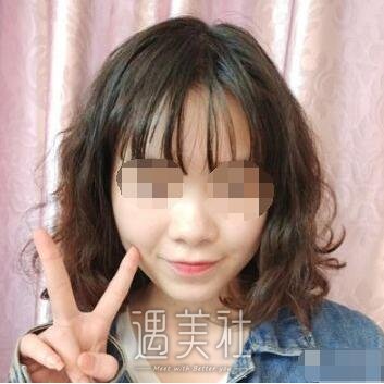 长治市天成美容医院隆鼻案例分享，拥有漂亮的鼻子是如此重要!