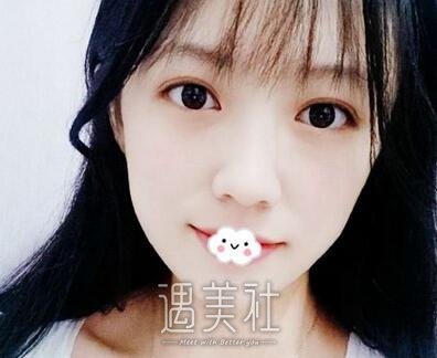 邱文苑,双眼皮