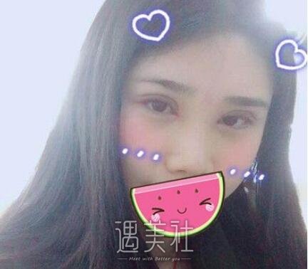 高寿松,双眼皮