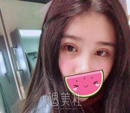 高寿松,双眼皮