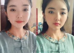 你看现在的她神似《知否知否》的明兰吗？ width=