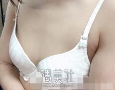 栾杰,隆胸
