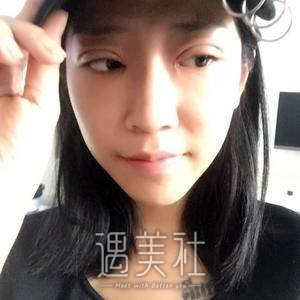 江宝华,双眼皮