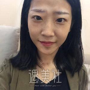 江宝华,双眼皮