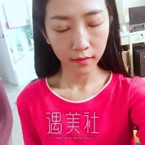 江宝华,双眼皮