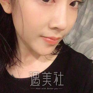 江宝华,双眼皮