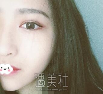 华西医院,肖海涛,双眼皮