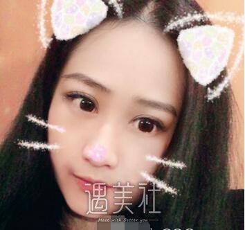 华西医院,肖海涛,双眼皮