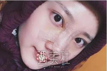 李青峰,做鼻子