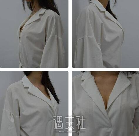 高柳进,隆胸