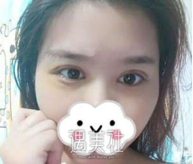 杨亚益,双眼皮