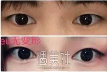 深圳北大医院