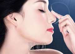 南阳伊维兰隆鼻多少钱，一般价格贵不贵？ width=