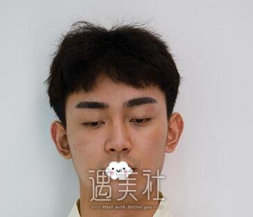 杨庆峰,双眼皮