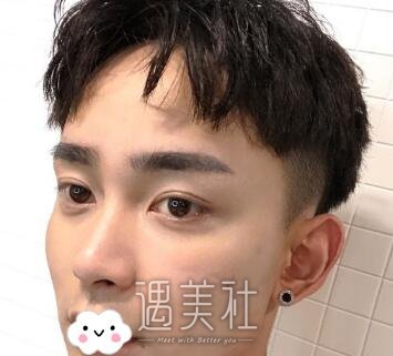 杨庆峰,双眼皮
