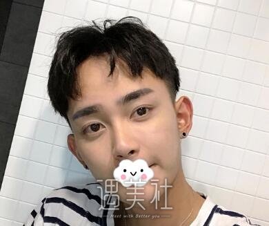 杨庆峰,双眼皮