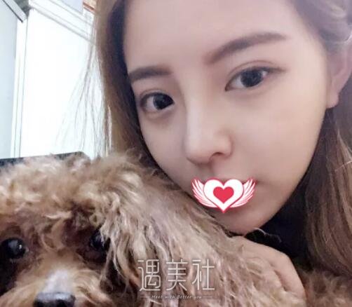 王涛,隆鼻