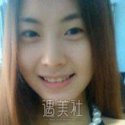 九院周一雄双眼皮案例：单眼皮变双眼皮大作战! width=