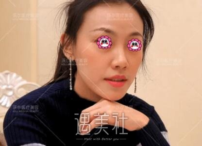 刘彦军,隆鼻