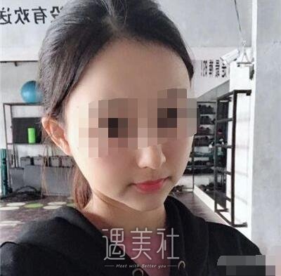 上海首尔丽格做下颌角怎么样?在线案例一览~