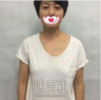雅美,肖征刚,丰胸