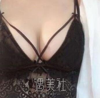雅美,肖征刚,丰胸
