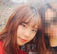 黄金龙隆鼻案例 不敢相信变化会这么大 width=