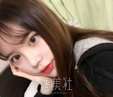 黄金龙,隆鼻