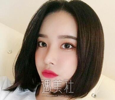 朱晓峰,双眼皮修复