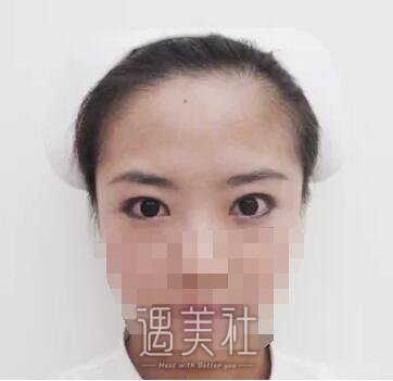 秦皇岛巧致失败案例有吗?成功的也可以看看!