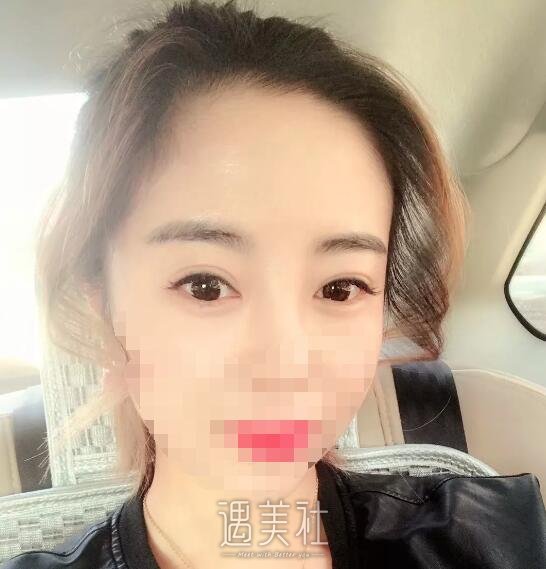 秦皇岛巧致失败案例有吗?成功的也可以看看!