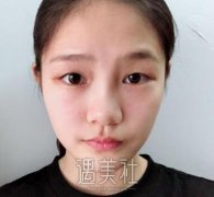 新华美天张景中案例分享：医生找对了灰常关键！ width=
