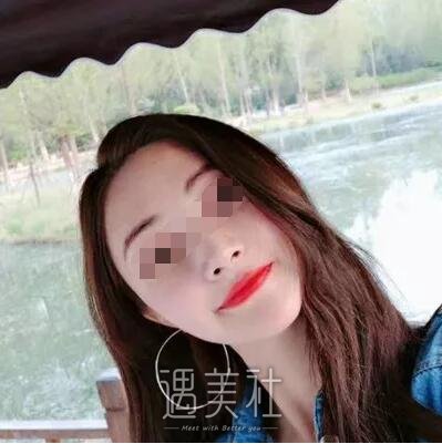 南京鼓楼医院整形科怎么样?有颧骨内推相关案例吗?