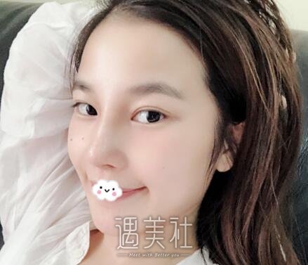 上海,邱文苑,隆鼻