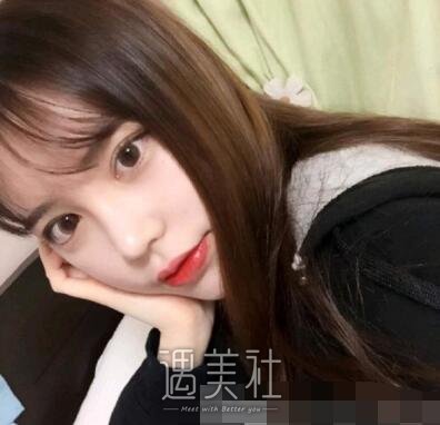 上海,九院,陈辉,隆鼻