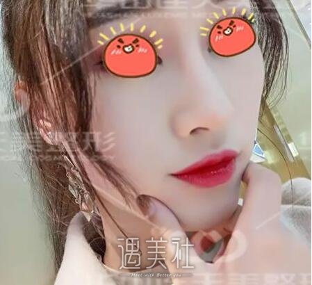 杭州,华山连天美,刘军,隆鼻