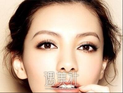 重庆,华美,李富强,双眼皮
