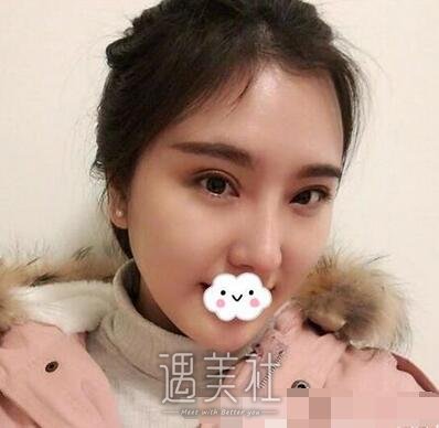 上海,张余光,双眼皮