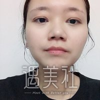 绵阳朗睿整形医院案例分享|看看其实力到底如何?