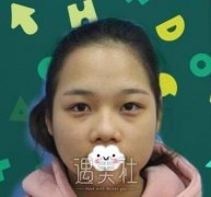 仇侃敏鼻子案例：仇医生大名早有耳闻！ width=