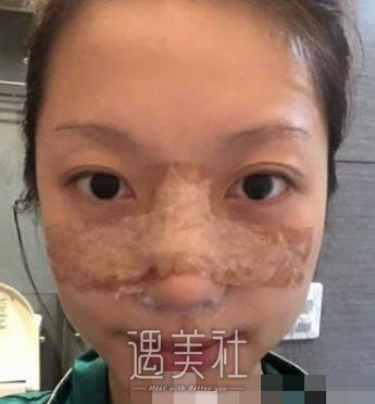 李战强,做鼻子