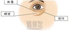 北京做光乳化去眼袋大概好多钱 width=