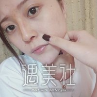 上海翔茂医疗美容案例流出，双眼皮技术是真的好!