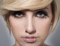 激光点痦子多久能洗脸?麻烦科普下~ width=