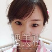 王晋煌双眼皮技术好吗?真实案例一览~ width=