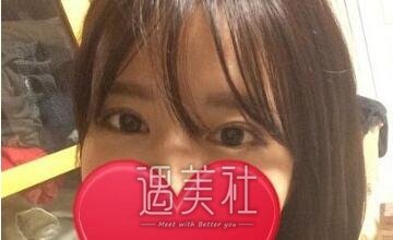 杨亚益双眼皮修复做得怎么样?真实案例一览~
