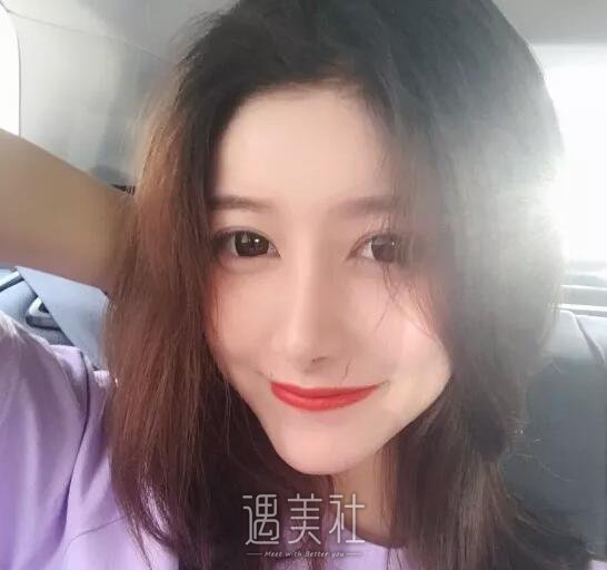 武汉亚太程晓林做鼻子技术怎么样?案例及果图一览~